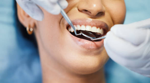 Best Knocked-Out Tooth Emergency  in Luverne, AL